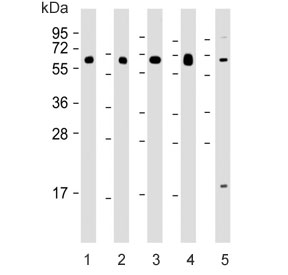 Western blot testing of human 1) lung, 2) kidney, 3) pancreas, 4) testis and 5) MDA-MB-453 lysate with HHLA2 antibody. Expected molecular weight: 38-60 kDa depending on glycosylation level.