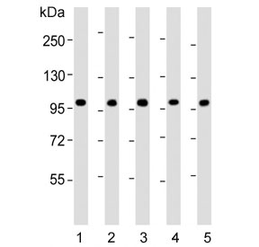 Western blot testing of human 1) CCRF-CEM, 2) Jurkat, 3) liver, 4) MCF7 and 5) HL60 lysate with RSBN1 antibody. Predicted molecular weight ~91 kDa.