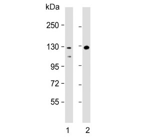 Western blot testing of human 1) Raji and 2) HL60 cell lysate with TERT antibody. Predicted molecular weight: 120-126 kDa (two isoforms may be visualized).