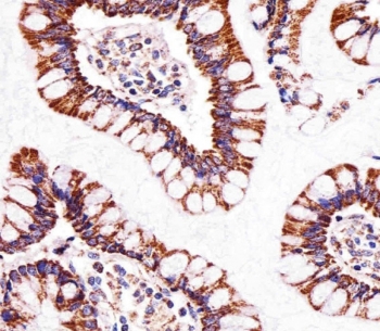 IHC testing of FFPE human small intestine tissue with ATP5B antibody. HIER: steam section in pH6 citrate buffer for 20 min and allow to cool prior to staining.