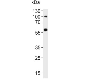 Western blot testing of human ovary lysate with RYK antibody. Predicted molecular weight ~68 kDa.