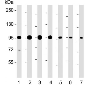 Western blot testing of human 1) HeLa, 2) HT-29, 3) K562, 4) LNCaP, 5) mouse brain, 6) mouse liver and 7) rat heart lysate with SCAP antibody. Predicted molecular weight: ~96, 98, 140 kDa (3 isoforms).