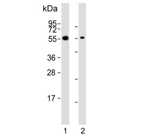 Western blot testing of human 1) 293T and 2) TT cell lysate with CDC73 antibody. Predicted molecular weight ~61 kDa.