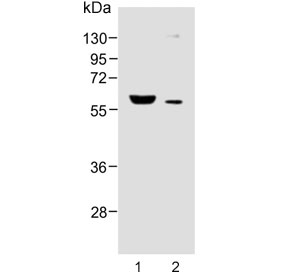 Western blot testing of human 1) breast and 2) liver lysate with FADS2 antibody. Predicted molecular weight ~52 kDa.