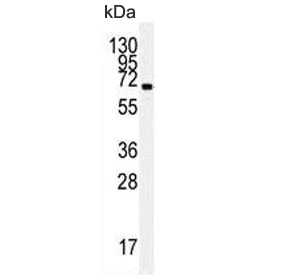 Western blot testing of human HL60 cell lysate with HSPA5 antibody. Predicted molecular weight: ~73 kDa, but routinely observed at 70-78 kDa.