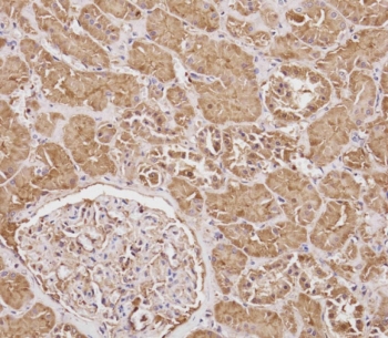IHC testing of FFPE human kidney tissue with SERPINA6 antibody. HIER: steam section in pH6 citrate buffer for 20 min and allow to cool prior to staining.