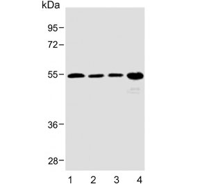 Western blot testing of human 1) heart, 2) kidney, 3) skeletal muscle and 4) SK-BR-3 lysate with SPNS2 antibody. Predicted molecular weight ~58 kDa.
