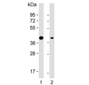 Western blot testing of human 1) U-251 and 2) U-2 OS cell lysate with Adiponectin Receptor 2 antibody. Predicted molecular weight ~44 kDa.