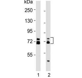 Western blot testing of human 1) HCT-116 and 2) MCF7 cell lysates with ESRP1 antibody. Predicted molecular weight: 68-76 kDa (multiple isoforms).