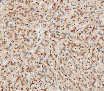 IHC testing of FFPE human liver tissue with Hexosaminidase A antibody. HIER: steam section in pH9 EDTA for 20 min and allow to cool prior to staining.