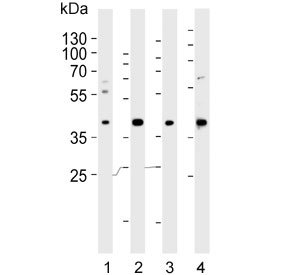 Western blot testing of human 1) A549, 2) HUVEC, 3) liver and 4) placenta lysate with LOX-1 antibody. Predicted molecular weight: pro-form 35-50 kDa, mature form ~31 kDa.