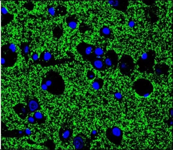 Immunofluorescent staining of human brain tissue with Synaptophysin antibody (green) and DAPI nuclear stain (blue).