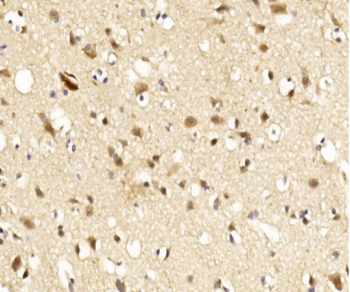 IHC testing of FFPE human brain tissue with Lingo1 antibody. HIER: steam section in pH6 citrate buffer for 20 min and allow to cool prior to staining.