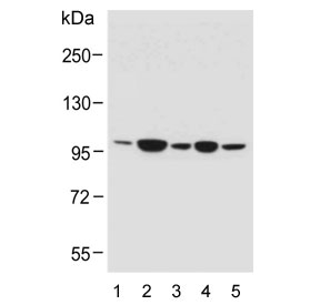 Western blot testing of human 1) RPMI-8226, 2) A549, 3) A431, 4) HT-1080 and 5) MCF7 cell lysate with RHBDF2 antibody. Predicted molecular weight ~97 kDa.