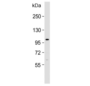 Western blot testing of human HepG2 cell lysate with FGFR4 antibody. Expected molecular weight: 88~125 kDa depending on phosphorylation and glycosylation level.