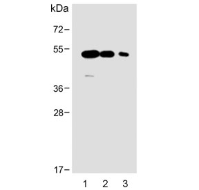 Western blot testing of human 1) brain, 2) breast and 3) placenta lysate with ENT1 antibody.  Predicted molecular weight ~50 kDa.