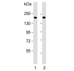 Western blot testing of human 1) lung and 2) plasma lysate with Complement factor H antibody. Predicted molecular weight ~139 kDa but may be observed at a higher molecular weight due to glycosylation.
