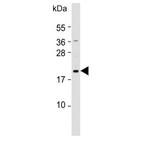 Western blot testing of human SW620 cell lysate with NUDT15 antibody. Predicted molecular weight ~19 kDa.