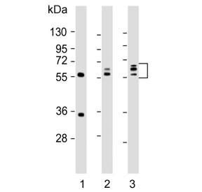 Western blot testing of human 1) HeLa, 2) HL60 and 3) KG-1 cell lysate with Fibroleukin antibody. Predicted molecular weight: 50-70 kDa depending on level of glycosylation.