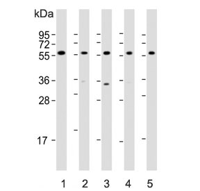Western blot testing of human 1) HepG2, 2) Li-7, 3) U-87 MG, 4) testis and 5) mouse testis lysate with DHCR7 antibody. Predicted molecular weight ~54 kDa.