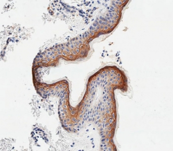 IHC testing of FFPE human skin tissue with Sciellin antibody. HIER: steam section in pH9 EDTA for 20 min and allow to cool prior to staining.