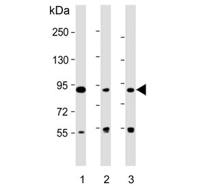 Western blot testing of human 1) HT-1080, 2) K562 and 3) RPMI 8226 cell lysate with DIEXF antibody. Predicted molecular weight ~87 kDa.