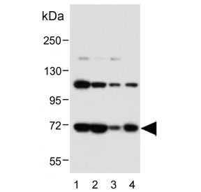 Western blot testing of human 1) K562, 2) MCF7, 3) HepG2 and 4) A431 cell lysate with Acid Sphingomyelinase antibody. Predicted molecular weight ~70 kDa.