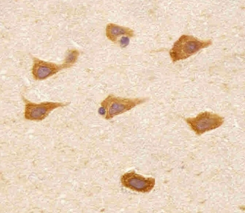 IHC testing of FFPE human brain tissue with PREX1 antibody. HIER: steam section in pH6 citrate buffer for 20 min and allow to cool prior to staining.