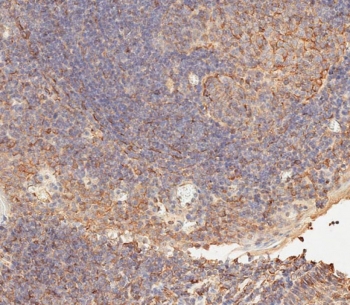 IHC testing of FFPE human tonsil tissue with CD276 antibody. HIER: steam section in pH9 EDTA for 20 min and allow to cool prior to staining.