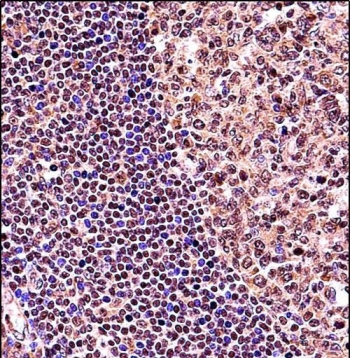 IHC testing of FFPE human tonsil tissue with TCF3 antibody. HIER: steam section in pH6 citrate buffer for 20 min and allow to cool prior to staining.