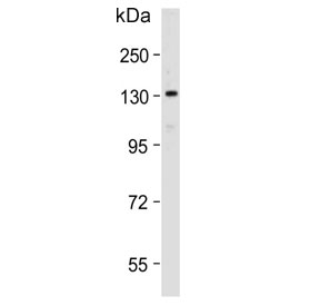 Western blot testing of human HepG2 cell lysate with POLG antibody. Predicted molecular weight ~140 kDa.