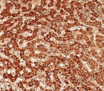 IHC testing of FFPE human liver tissue with ATG7 antibody. HIER: steam section in pH9 EDTA for 20 min and allow to cool prior to staining.