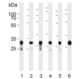 Western blot testing of human 1) A431, 2) HeLa, 3) HepG2, 4) MCF7, 5) U-251 MG and 6) mouse brain lysate with Cytochrome C1 antibody. Predicted molecular weight ~35 kDa.
