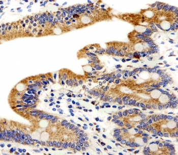 IHC testing of FFPE human small intestine tissue with ADRA1D antibody. HIER: steam section in pH6 citrate buffer for 20 min and allow to cool prior to staining.