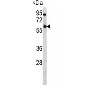 Western blot testing of human A2058 cell lysate with USP14 antibody. Predicted molecular weight ~56 kDa.