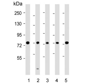 Western blot testing of human 1) MCF7, 2) HeLa, 3) SH-SY5Y, 4) Jurkat and 5) HL60 cell lysate with KIF22 antibody. Predicted molecular weight ~73 kDa.