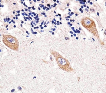 IHC testing of FFPE human cerebellum tissue with TENT2 antibody. HIER: steam section in pH6 citrate buffer for 20 min and allow to cool prior to staining.