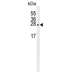 Western blot testing of mouse brain lysate with Pro-MCH antibody.