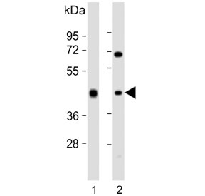Western blot testing of human 1) liver and 2) Jurkat cell lysate with ADH1B antibody. Predicted molecular weight ~40 kDa.