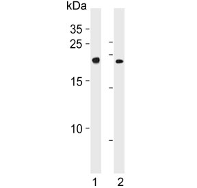 Western blot testing of 1) human K562 and 2) mouse lung lysate with CBFB antibody. Predicted molecular weight ~22 kDa.