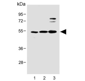 Western blot testing of human 1) U-2 OS, 2) SH-SY5Y and 3) MOLT4 cell lysate with LYK5 antibody. Predicted molecular weight ~48 kDa.