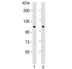 Western blot testing of rat 1) C2C12 and 2) rat brain lysate with Hexokinase antibody. Predicted molecular weight ~102 kDa.