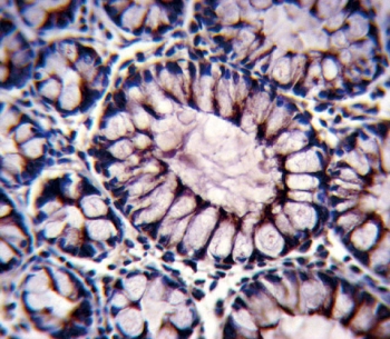 IHC testing of FFPE human colon tissue with PIGR antibody. HIER: steam section in pH6 citrate buffer for 20 min and allow to cool prior to staining.
