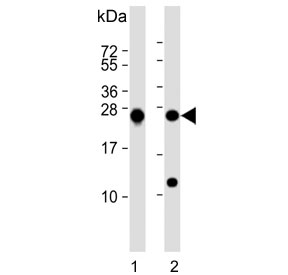 Western blot testing of human 1) K562 and 2) MCF7 cell lysate with PSMB1 antibody. Predicted molecular weight ~26 kDa.