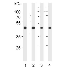 Western blot testing of 1) human HEK293, 2) human HEK293T, 3) mouse liver and 4) rat liver lysate with OAT antibody. Predicted molecular weight ~49 kDa.