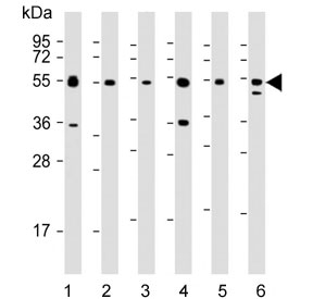 Western blot testing of 1) monkey COS-7 and human 2) Daudi, 3) HepG2, 4) HT-29, 5) Jurkat and 6) MCF7 cell lysate with IRF3 antibody. Predicted molecular weight ~47 kDa.