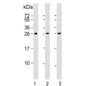 Western blot testing of human 1) A431, 2) skeletal muscle and 3) brain lysate with Density Regulated Protein antibody. Expected molecular weight ~22 kDa (unmodified), 27-31 kDa (modified).