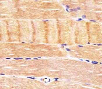 IHC testing of FFPE human skeletal muscle tissue with CDK5 antibody. HIER: steam section in pH6 citrate buffer for 20 min and allow to cool prior to staining.