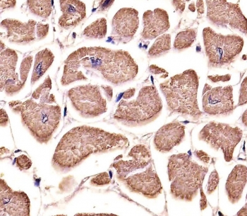 IHC testing of FFPE human heart tissue with IRF7 antibody. HIER: steam section in pH6 citrate buffer for 20 min and allow to cool prior to staining.