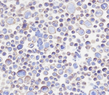 Immunocytochemical testing of PFA-fixed human 293T cells with B7-H3 antibody. HIER: pH9 EDTA.